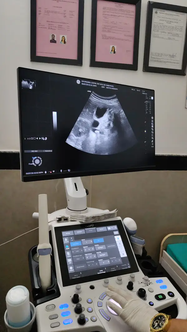 Ultrasound machine displaying a scan image in a scanning room at Om Imaging Centre